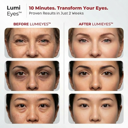 LumiEyes™